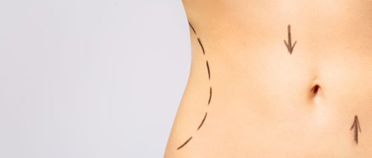 What Are The Differences Between Body Contouring And After Weight Loss Surgery